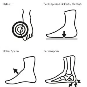 Der richtige Schuh bei Fußfehlstellungen: Wir helfen Ihnen!