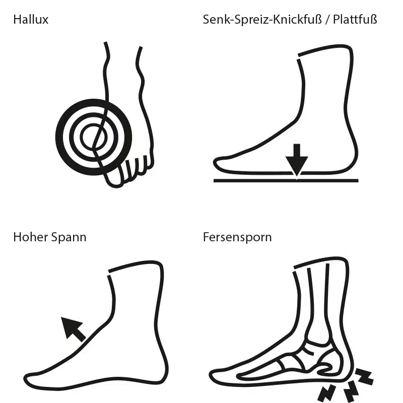 Der richtige Schuh bei Fußfehlstellungen: Wir helfen Ihnen!